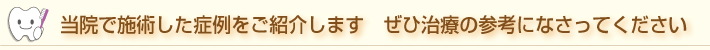 症例をご紹介します!
